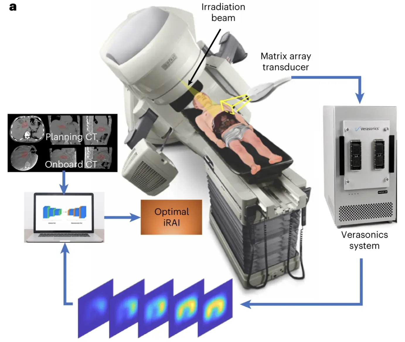 Real-Time Radiation Tracking Unlocks Safer Cancer Treatment