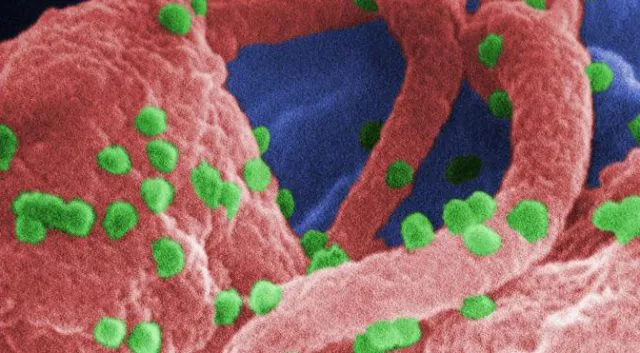Scientists Use CRISPR to Block HIV Replication Inside Living Cells