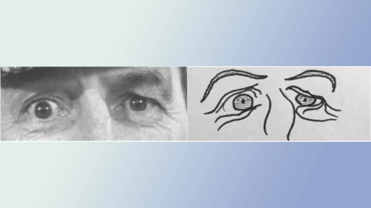 Study: Autistic People Recognize Emotions Better Than Neurotypical in Cartoons