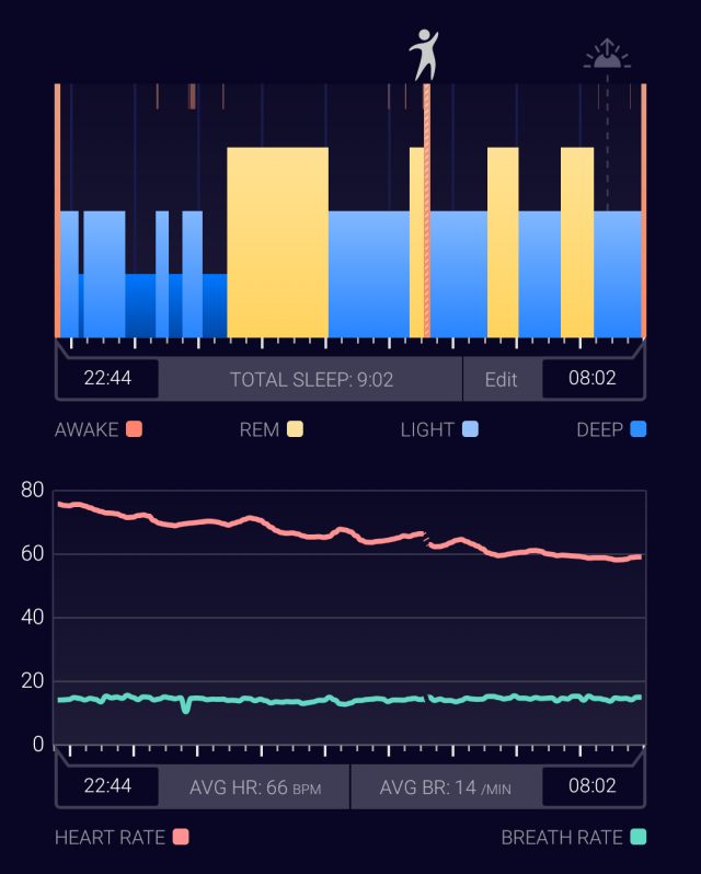 Хмара та власний датчик AI, що використовують Sleeptracker, призводять до даних про сон, які я відчуваю найбільш впевненим.