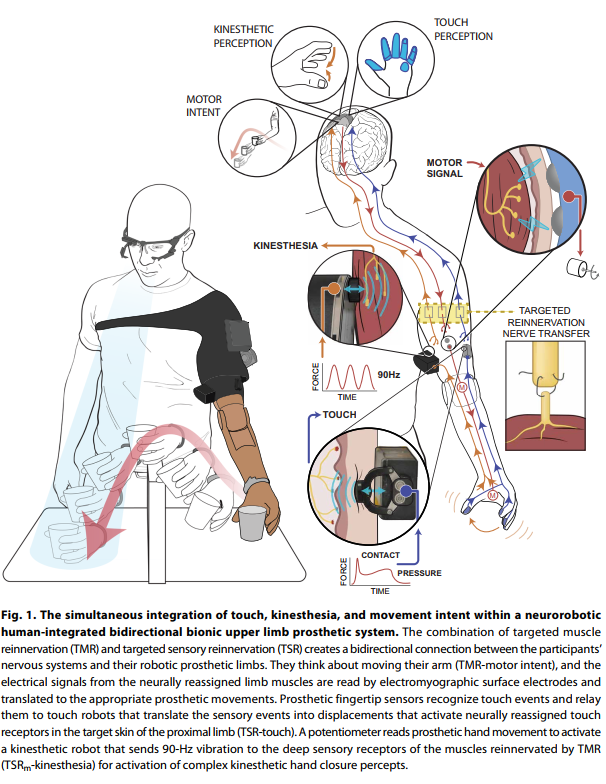 New Bionic Arm Lets Amputees Feel Touch, Retrofits to Existing Prosthetics