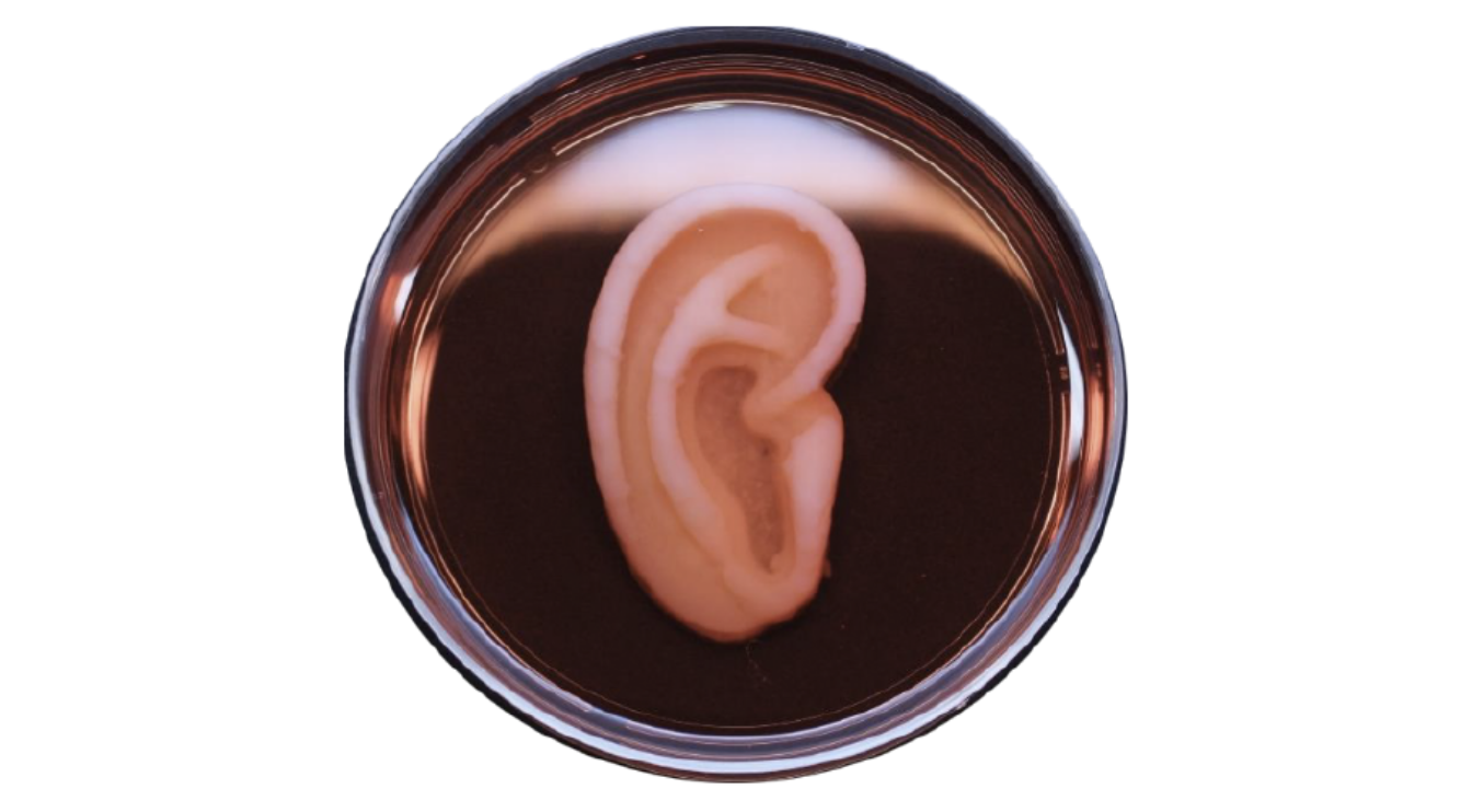 Doctors 3D Print An Ear Made of Human Cells