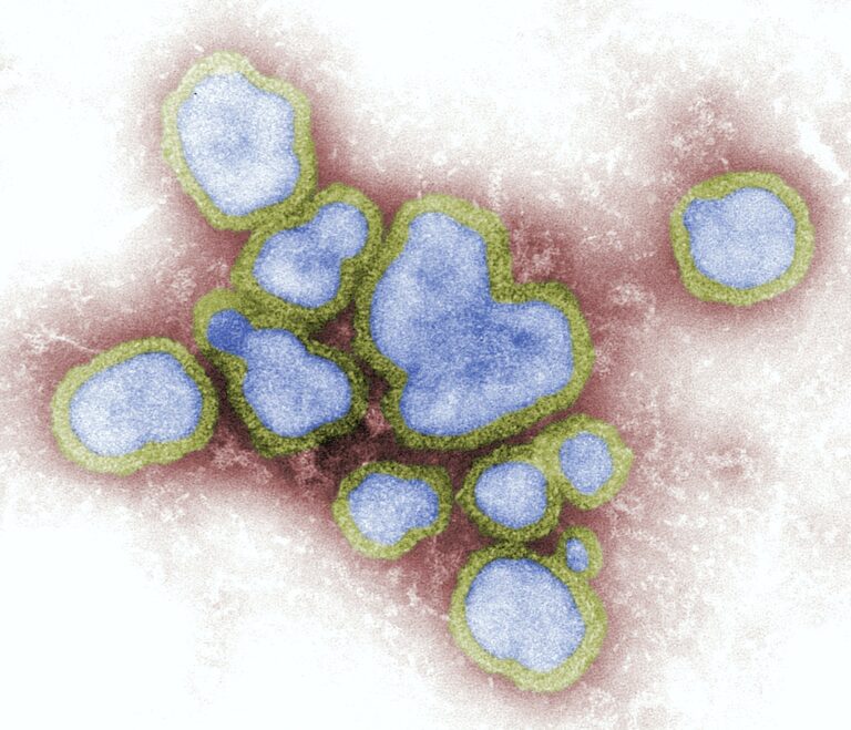 New Research Explains Why Cold, Flu Viruses Are More Common in Winter